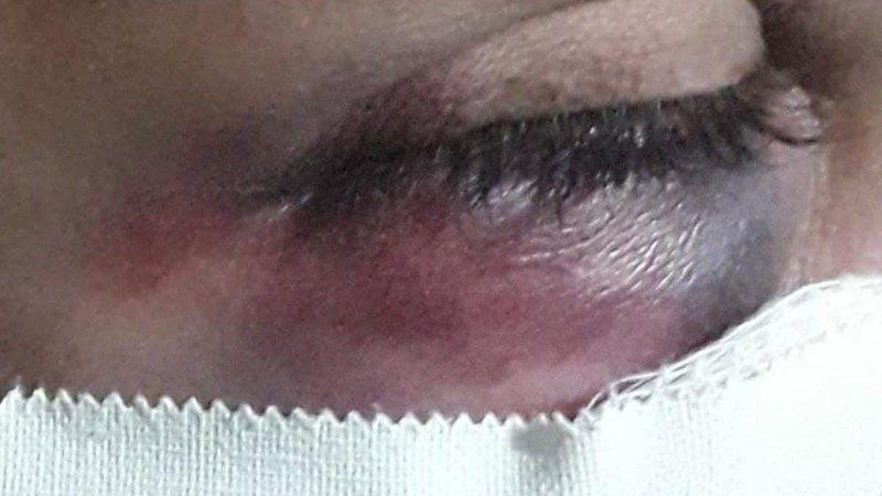 Mulher é socorrida após ser espancada e marido é preso pela PM Mulher é socorrida após ser espancada e marido é preso pela PM