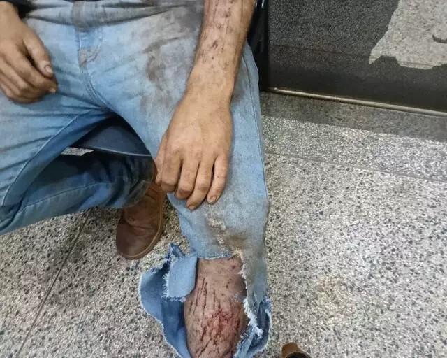 Jovem diz que foi atacado por onça enquanto trabalhava em colheitadeira
