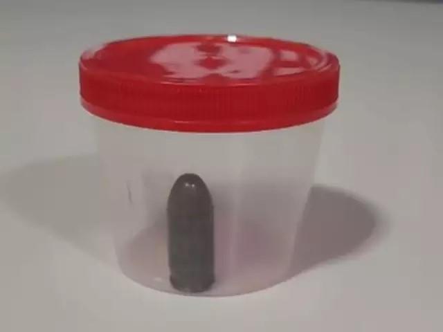 Munição intacta é retirada do intestino de homem durante cirurgia em Sidrolândia.